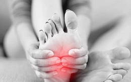 Nếu bàn chân bạn xuất hiện 5 dấu hiệu này, có thể là cảnh báo bệnh nghiêm trọng: Hãy chú ý kỹ hơn khi rửa chân mỗi ngày