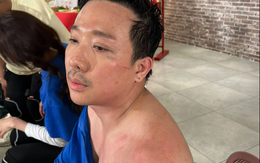 Trấn Thành tiếp tục phải trả giá