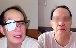 Nam NSND 81 tuổi phải phẫu thuật lần hai: "Hết rồi!"