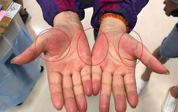 Nếu thường xuyên có 7 cảm giác này, rất có thể nhiều bệnh ung thư đang "thách thức", bạn cần đi khám ngay!