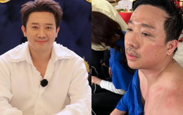 Trấn Thành kiệt quệ