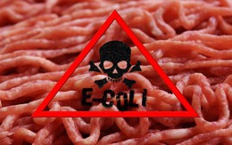 Giáo sư Mỹ tiết lộ 3 loại thực phẩm chứa độc tố, có thể gây ung thư: Nếu thấy phải vứt bỏ ngay!