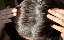 Bạc tóc đang trẻ hóa ở người Việt, có bé 6 tuổi tóc đã bạc trắng: Bác sĩ giải mã bí ẩn phía sau