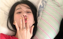 5 điều lưỡi có thể tiết lộ về sức khỏe: Từ ung thư đến nguy cơ đột quỵ cũng có thể hiện ra!