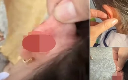 Xác minh vụ giáo viên tiểu học véo tai học sinh lớp 1 chảy máu ở Phú Quốc