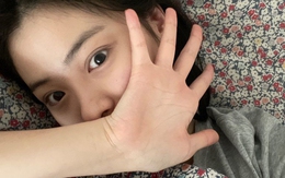 4 bất thường cho thấy cơ thể chị em tích tụ đầy độc tố bác sĩ khuyên: Ăn 4 thứ và làm 3 việc