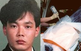 83 ngày cuối đời đau đớn của người nhiễm phóng xạ nặng nhất lịch sử nhân loại 83 ngày cuối đời đau đớn của người nhiễm phóng xạ nặng nhất lịch sử nhân loại