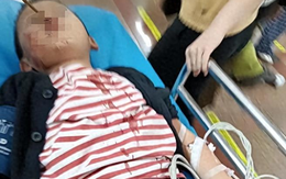 Gửi con đi nhà trẻ, giữa trưa người mẹ tái mặt vì nhận 1 cuộc gọi : Đòi trường mầm non bồi thường 1,7 tỷ Gửi con đi nhà trẻ, giữa trưa người mẹ tái mặt vì nhận 1 cuộc gọi : Đòi trường mầm non bồi thường 1,7 tỷ