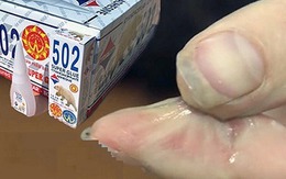 Tay dính keo 502, đau khổ hơn rơi xuống hố - Bình tĩnh vì trong nhà sẵn 5 giọt "nước thần" cứu bạn!