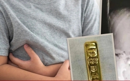 Thỏi vàng nặng 100gr bị cậu bé nuốt vào bụng, phải phẫu thuật để lấy ra