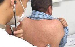Cả nước ghi nhận hơn 76.300 trường hợp nghi sởi