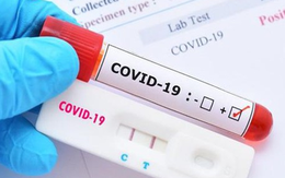 NÓ789bet: 83% mẫu COVID-19 tại TP HCM là biến chủ789bet mới NB.1.8.1