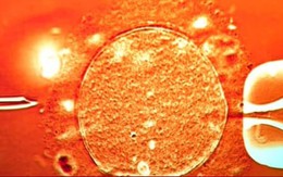 67 trẻ sinh ra từ tinh trùng người hiến mang gene 789bet.com đăng nhập thư, 10 trẻ mắc bệnh