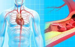 Mạch máu càng trẻ, càng sống lâu: Bác sĩ chỉ cách kiểm tra và làm sạch mạch máu Mạch máu càng trẻ, càng sống lâu: Bác sĩ chỉ cách kiểm tra và làm sạch mạch máu