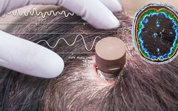 Người đàn ông bị liệt chỉnh sửa video, đăng YouTube 'chỉ bằng suy nghĩ': Ca cấy chip nhà cái 789bet Neuralink thứ ba gây chấn động