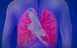 Ngồi không cũng nhiễm vi nhựa - Chuyên gia cảnh báo ô nhiễm vi nhựa trong không khí, con người có thể hít vào lượng vi nhựa to bằng hươu cao cổ