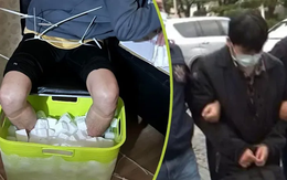 Ngâm chân trong đá lạnh 10 tiếng để lừa bảo hiểm, nam sinh viên bị cắt cụt cả hai bàn chân