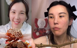 Mặt nữ mukbang biến dạng nghiêm trọng sau 2 năm hành nghề