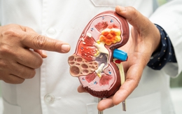 1 phút tự “SOI THẬN” tại nhà, khỏe hay yếu nhìn là biết: Lời khuyên từ “thầy thuốc thế hệ vàng” 40 năm kinh nghiệm