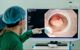 Sụt 3kg trong 3 tháng, người đàn ông phát hiện mắc hai loại ung thư cùng lúc