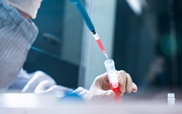 SIAM Thailand chính thức bước vào lĩnh vực y học tái tạo với Ngân hàng mô Vicells