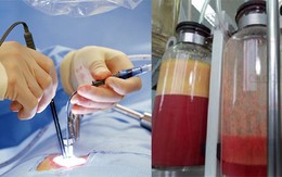 Bê bối của thị trường thẩm mỹ trị giá 22 tỉ USD: nạn nhân nức nở kể trải nghiệm HÚT MỠ đau đớn "như bị lột da sống"