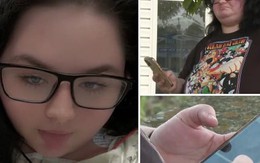 Nằm trong nhà, cô gái bị sét đánh qua dây sạc điện thoại, mất trí nhớ tạm thời