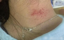 Phát hiện kim loại nặng độc hại vượt mức 1.179 lần cho phép trong loạt trang sức bán chạy nhất trên sàn thương mại điện tử