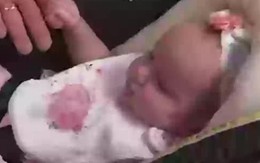 Em bé được "sinh ra hai lần" duy nhất trên thế giới