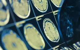 Công nghệ 17/8: Chip não giải mã suy nghĩ con người với độ chính xác 74%