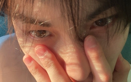 4 thay đổi ở đôi mắt là GƯƠNG PHẢN CHIẾU cả tá bệnh ung thư, tiếc là ít ai để ý