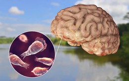 Phát hiện ‘amip ăn não’ trong nguồn nước sinh hoạt tại quốc gia có cộng đồng người Việt đông thứ 3 thế giới
