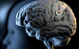 Stanford công bố nghiên cứu gây sốc: Chip não đọc được ý nghĩ chính xác tới 74% - Bước tiến khoa hay cơn ác mộng quyền riêng tư?