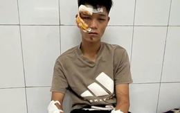 "Quái xế" khóc và khai về việc đi vào đường cấm, tông chiến sĩ cảnh sát cơ động