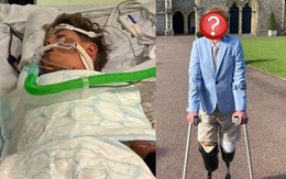 Bị chuột rút sau trại hè thể thao, cậu bé 13 tuổi phải cắt cụt 2 chân, cha mẹ lên tiếng cảnh báo