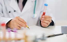 Mỡ máu tăng vọt dù không ăn dầu mỡ: Bác sĩ nói chính thói quen này là 'thủ phạm'