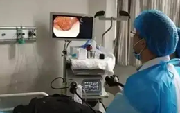 Người đàn ông qua đời vì ung thư đại tràng dù ngủ sớm, dậy sớm, thích đi bộ, bác sĩ lắc đầu: 4 thực phẩm yêu thích của nhiều người là nguyên nhân