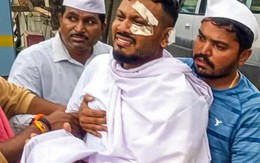 Tình hình hiện tại của người sống sót duy nhất trong thảm kịch máy bay Air India sau 3 tháng