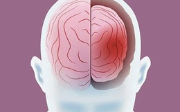 10 điều bộ não SỢ NHẤT: Có những hành vi dễ gây Alzheimer, teo não