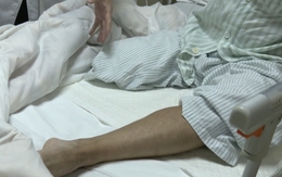 Người đàn ông bất ngờ phải cắt cụt bắp chân: Bác sĩ nói do chủ quan với 1 dấu hiệu bất thường