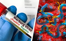 WHO cảnh báo "bệnh chảy máu mắt" lan rộng tại châu Phi