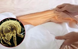 Vạch trần 2 ổ vi khuẩn rình rập ngay trên giường ngủ, bẩn đến mức không dám tin vào mắt mình!