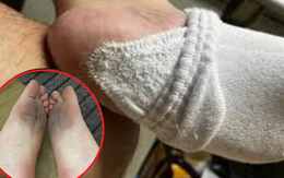 4 loại “tất độc” bị điểm tên, đừng ham rẻ mà rước bệnh vào người