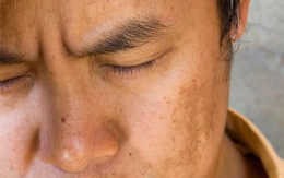 Cơ thể xuất hiện 4 biểu hiện bất thường này vào buổi sáng cảnh báo gan đang mang “mầm bệnh”: Có 3/4 thì phải đi khám ngay