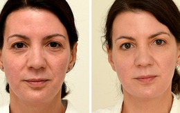 Thử nghiệm uống đủ lượng nước này trong 4 tuần, người phụ nữ 4x trẻ ra 10 tuổi