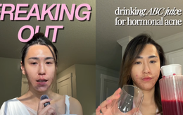 Bị đuổi việc, cô gái 27 tuổi để mặt mộc với mảng mụn lớn lên mạng tâm sự và cái kết bất ngờ