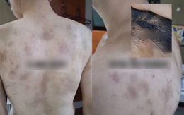 Rúng động Hàn Quốc: Nam nhân viên bị chủ quán hành hạ, ép làm việc 20 giờ/ngày, camera giám sát 24/7