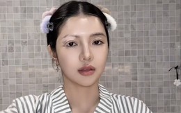 Mỹ nhân Việt mắc bệnh hiếm chỉ 2% dân số thế giới gặp phải