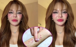 Video lúc nửa đêm của TikToker 11 triệu người theo dõi khiến nhiều người giật mình: Ung thư máu có đến từ thói quen thức khuya, uống trà sữa?