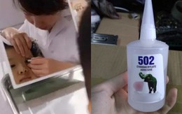Cậu bé 3 tuổi bắt chước bà nhưng nhỏ nhầm keo 502 vào mắt: Mẹ sơ cứu trong 15 phút, bác sĩ nói "không cần điều trị nữa"